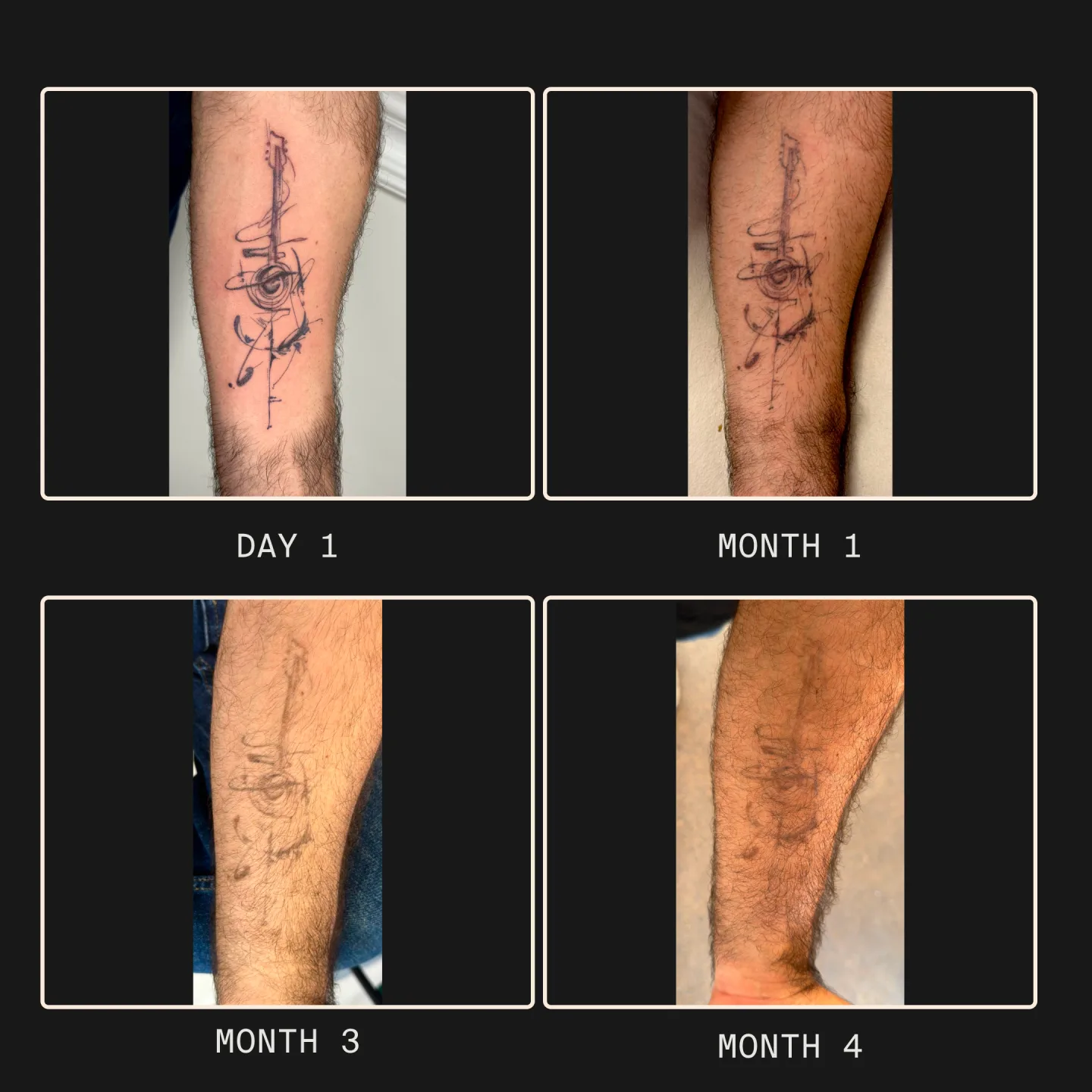 ギター(アブストラクト・ラインワーク)のエフェメラルタトゥーの退色経過(Day 1 → Month 4)