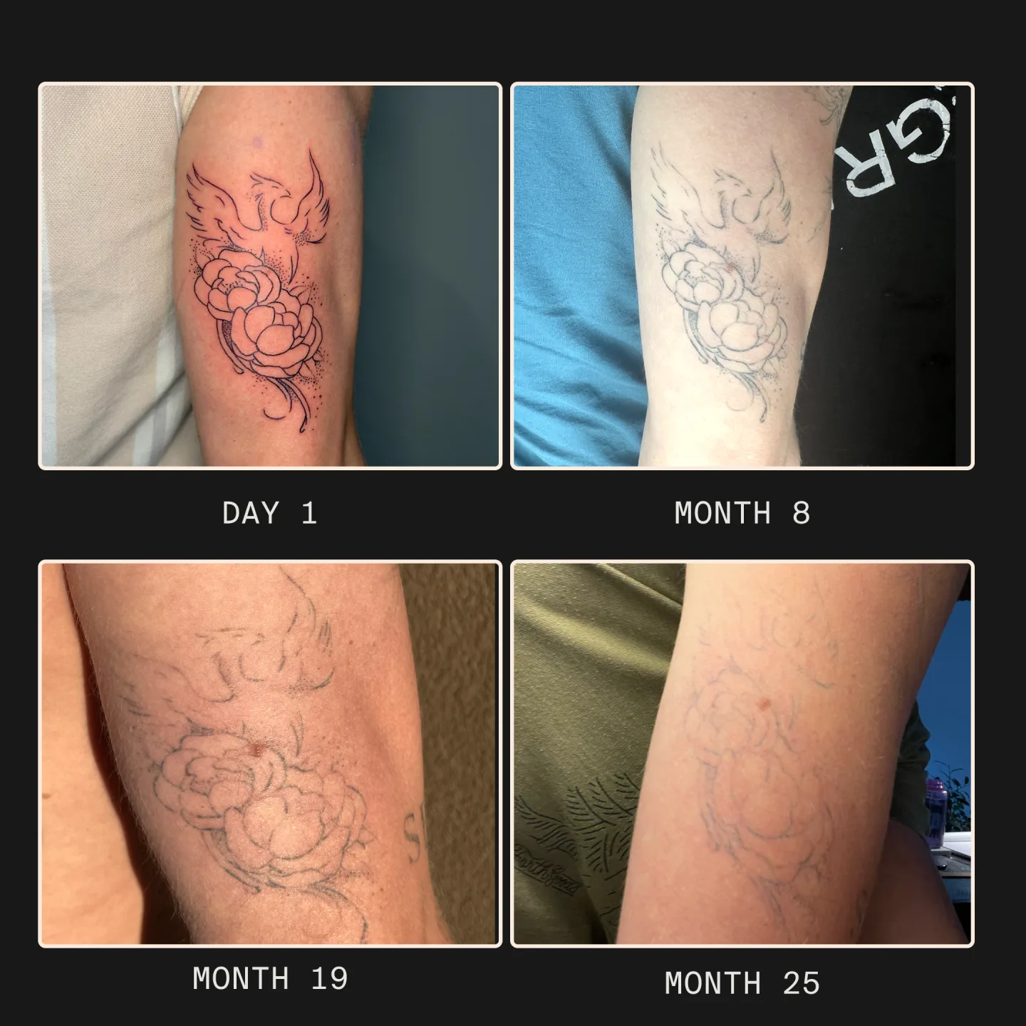 フェニックスと牡丹のエフェメラルタトゥーの退色経過(Day 1 → Month 25)